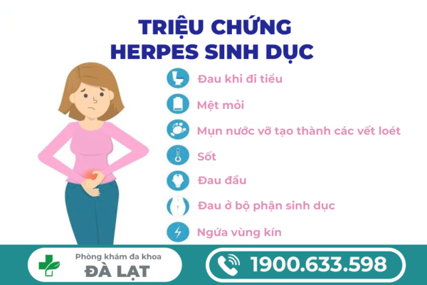 Hình ảnh minh họa